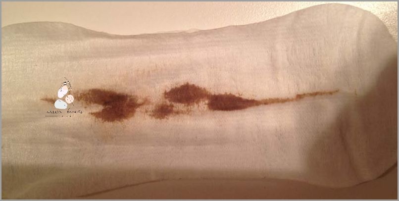 Biały Śluz Przed Okresem: Dowiedz Się Co Oznacza Biały Śluz Przed Okresem: Dowiedz Się Co Oznacza