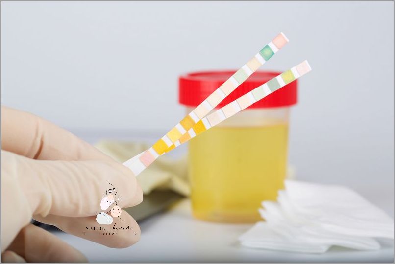 Co Oznacza Ślad Krwi W Moczu? Sprawdź!