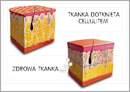 Cudowny Peeling Z Kawy Na Cellulit!