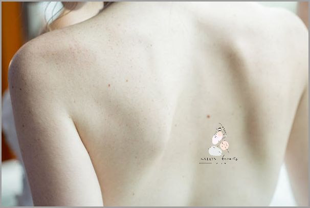 Czerniak pod Paznokciem - Niedoceniany Zagrożenia!