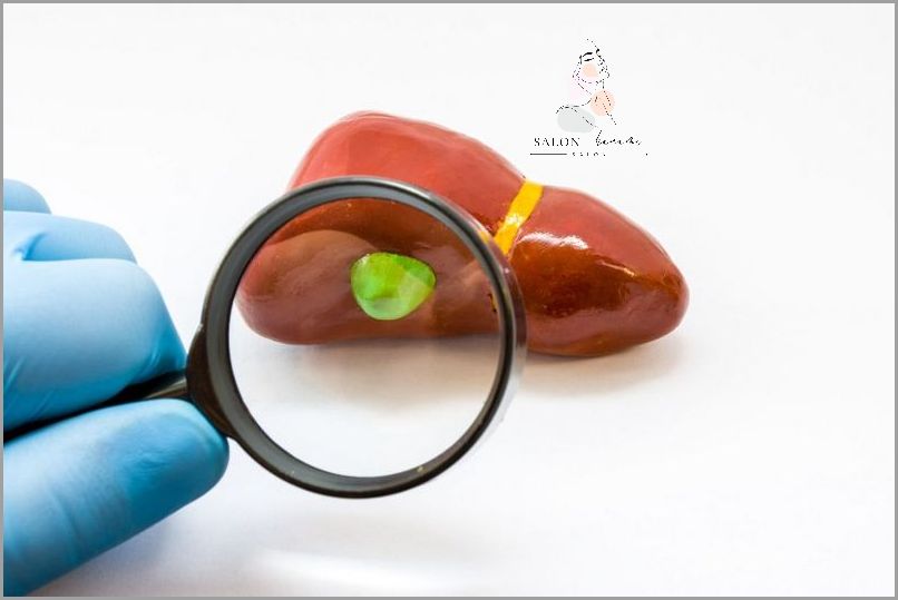 Czy Można Jeść Rosół Po Wycięciu Woreczka Żółciowego?