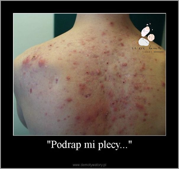 Domowe Sposoby na Schodzącą Skórę Z Twarzy! Domowe Sposoby na Schodzącą Skórę Z Twarzy!