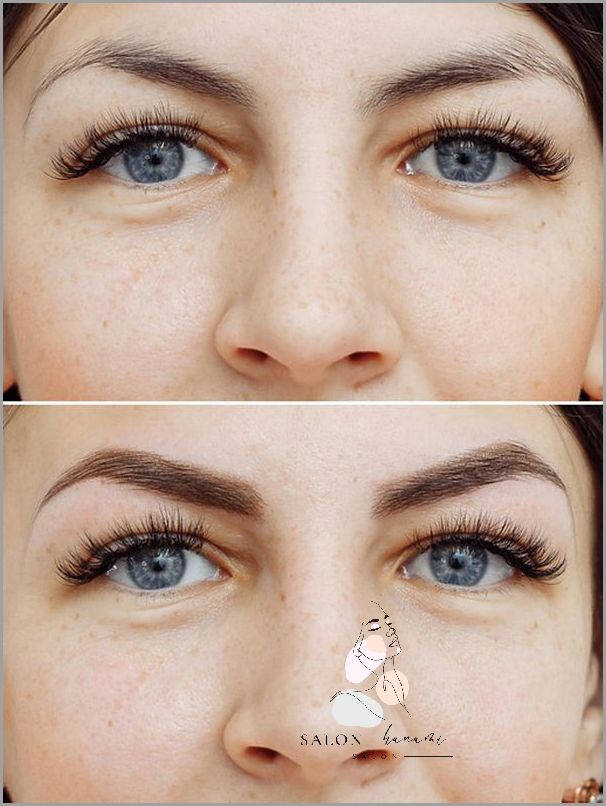 Efekty Stosowania Olejku Rycynowego Na Blizny!