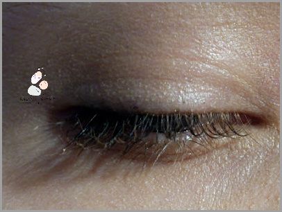 Efekty Stosowania Olejku Rycynowego Na Blizny!