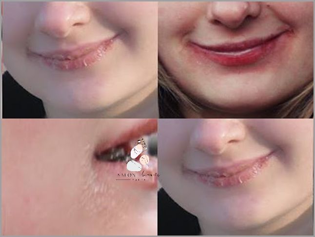 Efekty Uboczne Odżywek Proteinowych Do Włosów!