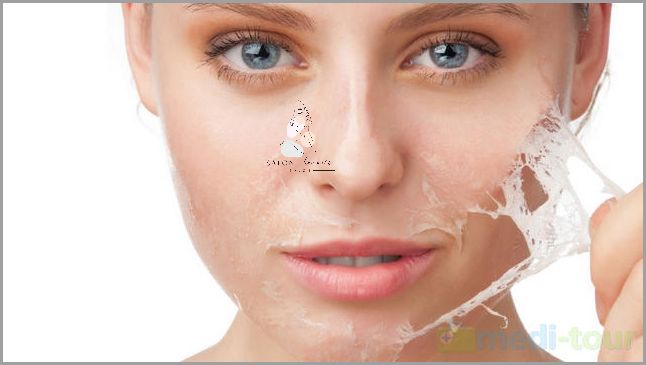 Element Peeling Trychologiczny - Cudowny Sposób na Piękną Skórę!