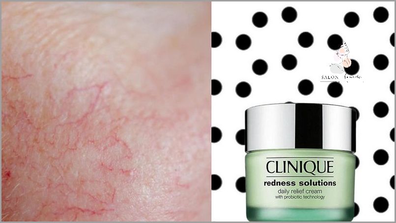 Forum: Sprawdź, Co O Kremie Do Cery Naczynkowej!