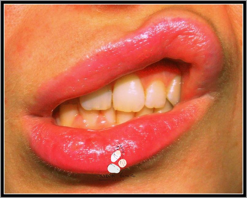 Jak Dbac O Usta? Sprawdz Nasze Porady! Jak Dbac O Usta? Sprawdz Nasze Porady!