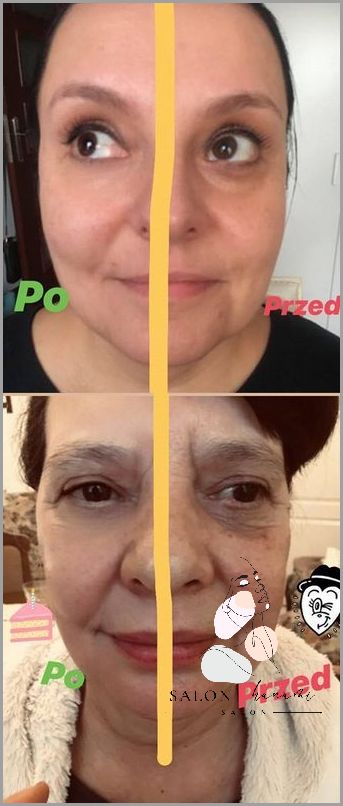 Jak Poprawić Owal Twarzy? Sprawdź Teraz!