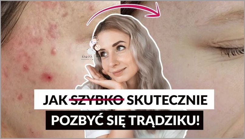 Jak Pozbyć Się Blizn Po Strupach? Sprawdź!
