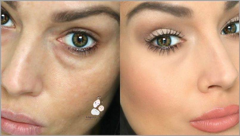 Jak Pozbyć Się Opuchniętych Oczu Po Nocy?