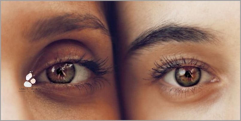 Jak Pozbyć Się Opuchniętych Oczu Po Nocy?