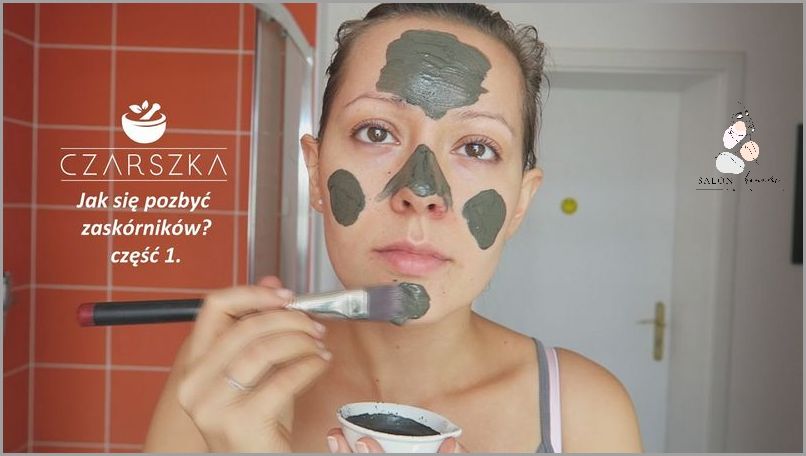 Jak Pozbyć Się Zaskórników Zamkniętych? Jak Pozbyć Się Zaskórników Zamkniętych?