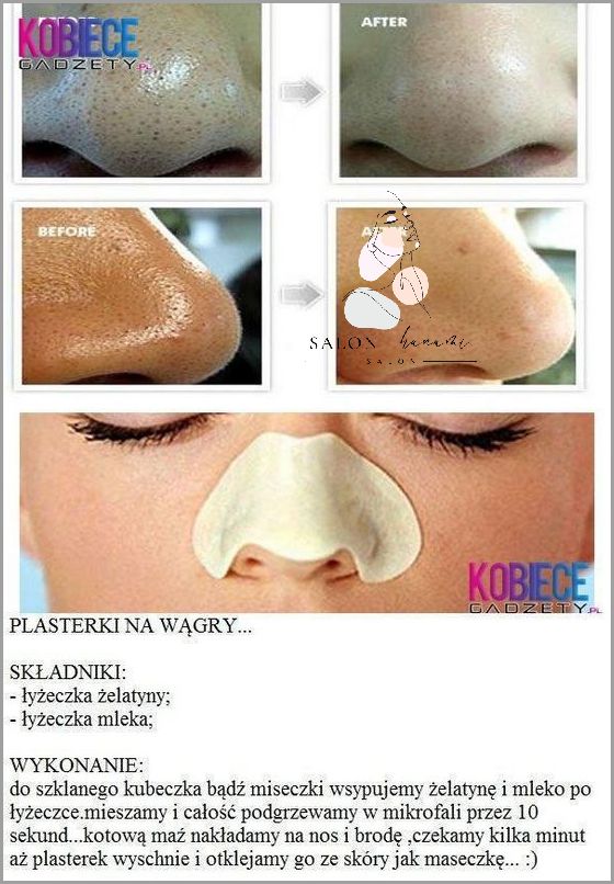 Jak Się Pozbyć Wąsika?