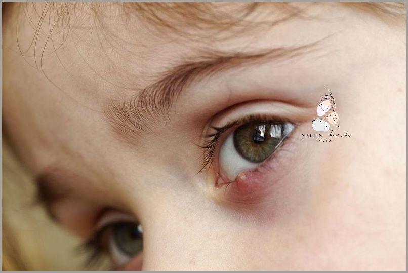 Jak Szybko Się Opalić? Domowe Sposoby!