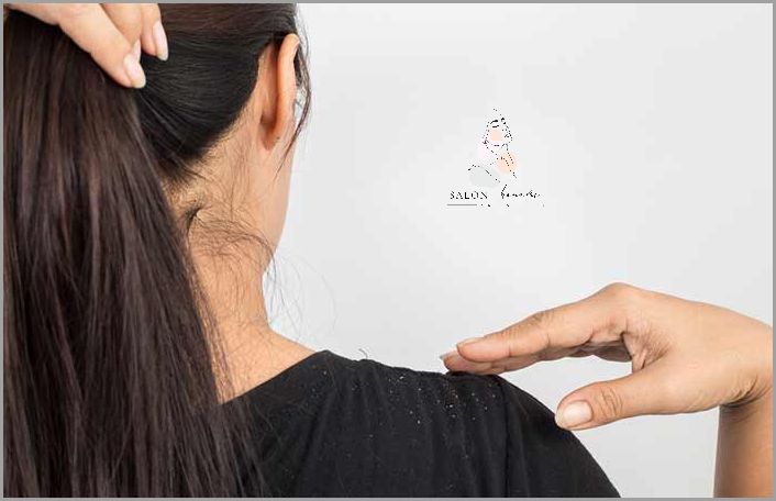 Jak Wyleczyć Podrażnioną Skórę Głowy - Sprawdź Teraz!