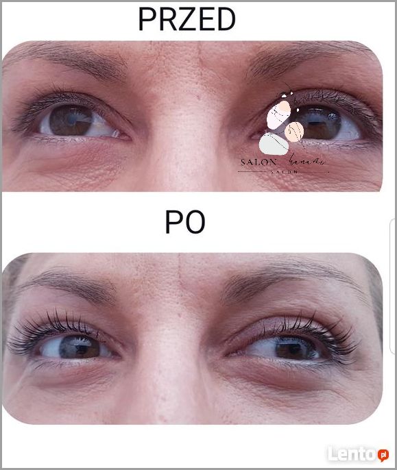 Lifting i Laminacja Rzęs - Sprawdź Cenę!