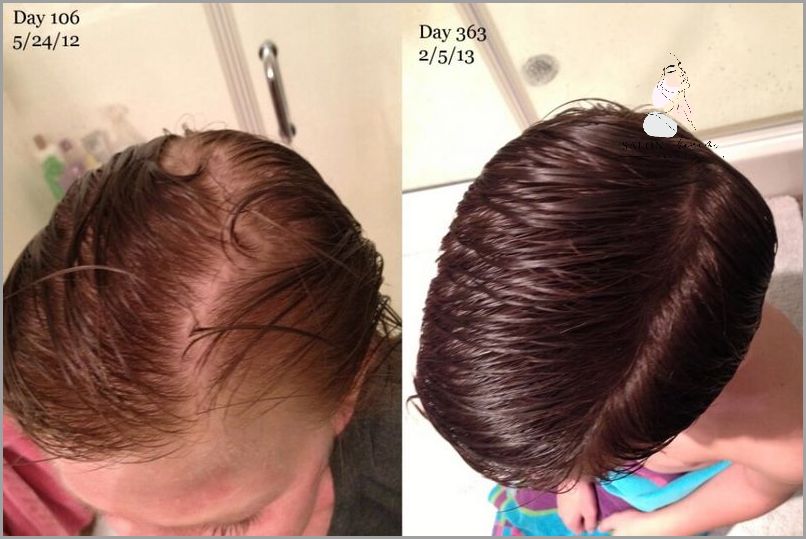 Naturalne Sposoby Na Porost Włosów: Czy To Działa?