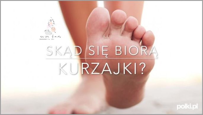 Odkryj Tajemnicę Skąd Się Biorą Kurzajki!