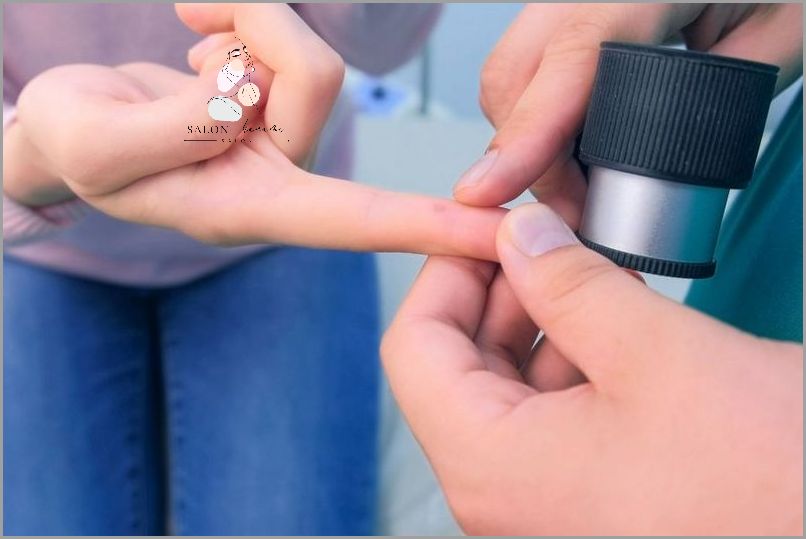 Odkryj Tajemnicę Skąd Się Biorą Kurzajki!