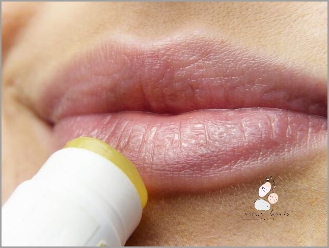 Pękające Usta Do Krwi: Co Się Dzieje?