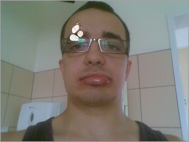 Progenia Przed i Po: Przerażające Zmiany!