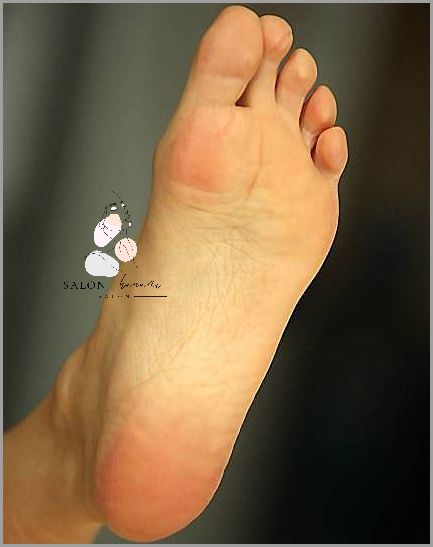 Stłuczenie Małego Palca W Stopie - Przerażające Skutki!