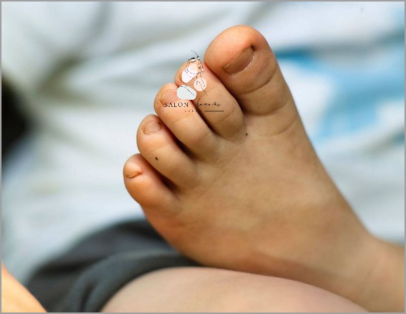 Szokujące Widoki: Odciski Na Stopie U Dziecka!