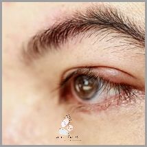 Szybko Uśmierz Opuchliznę: Okłady Z Altacetu!