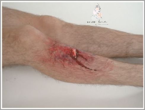 Uczucie Bólu Kości Ogonowej Bez Urazu!