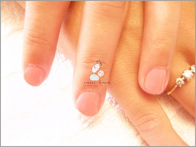 Uwaga! Sprawdź Przebarwienia Na Paznokciach U Nóg!