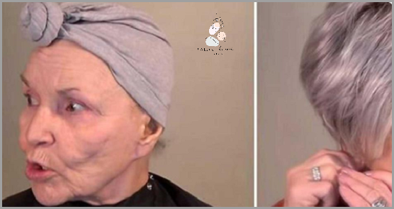 Widoczne Żyły Pod Oczami - Zobacz, Co Cię Czeka!