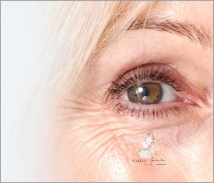 Zaskakujące Przyczyny Obrzęków Wokół Oczu!