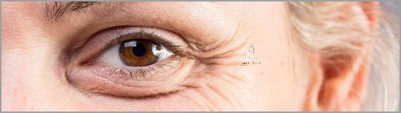 Zaskakujące Przyczyny Obrzęków Wokół Oczu!