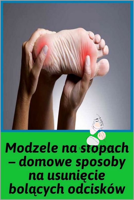Zaskakujące Sposoby Na Łuszczącą Się Skórę Na Stopach! Zaskakujące Sposoby Na Łuszczącą Się Skórę Na Stopach!