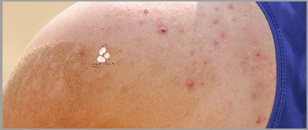 Dlaczego Wypadanie Włosów Po Narkozie Jest TAKIE Powszechne?