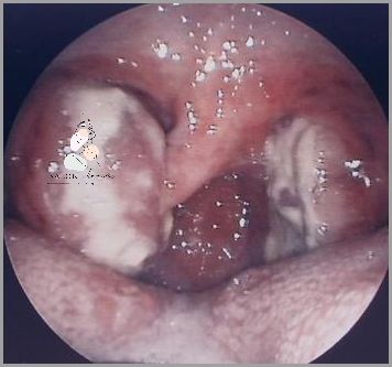 Gorączka 5 Dni U Dziecka? Forum Ci Pomaga! Gorączka 5 Dni U Dziecka? Forum Ci Pomaga!