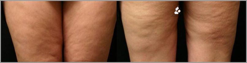 Jak Wyglada Orgazm U Kobiety? Sprawdź!