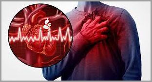 Jonoforeza - Co to jest?