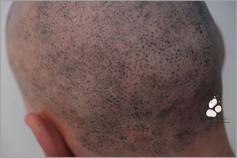 Niesamowite Zalety Masażera Do Skóry Głowy!