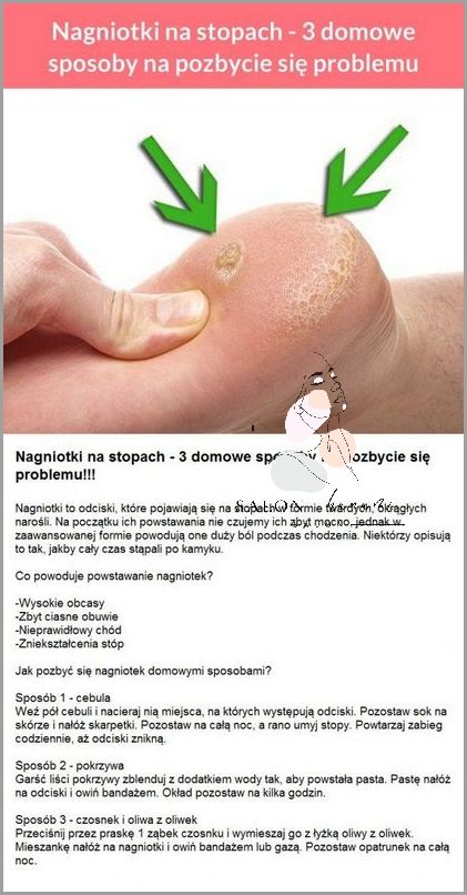 Odkryj Domowe Sposoby Na Włókniaki!