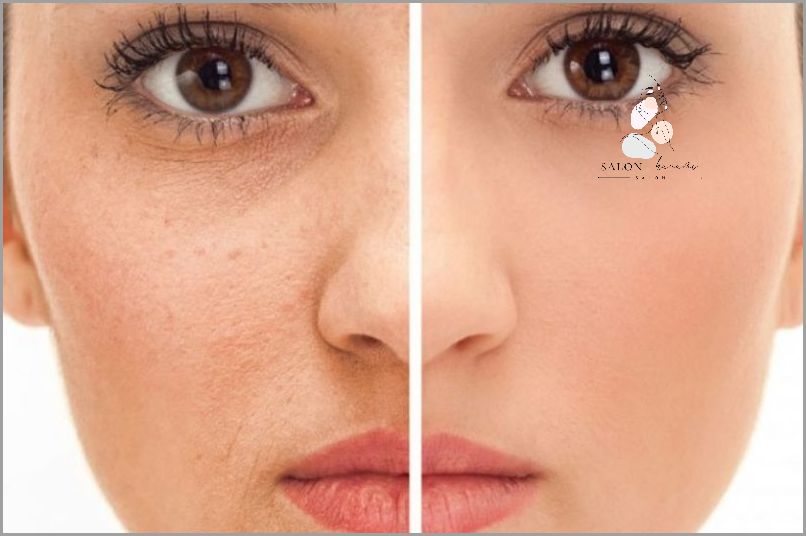 Odkryj Domowe Sposoby Na Włókniaki!