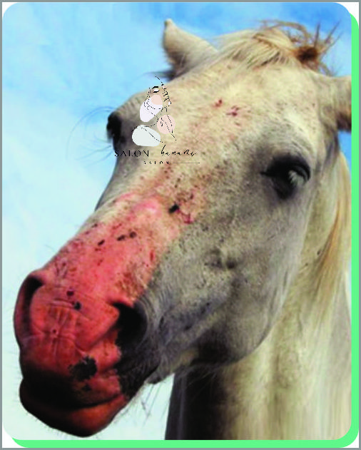 Ostrzegamy! Oparzenie Słoneczne 2 Stopnia może być niebezpieczne!