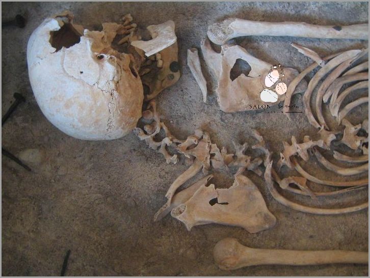 Tajemnica Jak Pozbyć Się Boczków Odkryta!