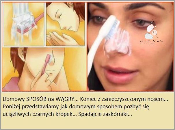 Ujawniamy Przyczynę Czarne Kropki Na Nosie!