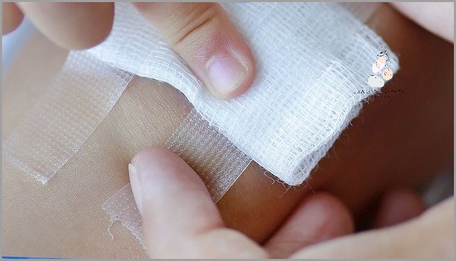 Uwaga! Iii Stopnia Oparzenia Słoneczne - Jak Uniknąć Ryzyka?.