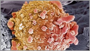 Uwaga! Zapalenie Mieszków Włosowych Na Nogach - Ostrzeżenie!