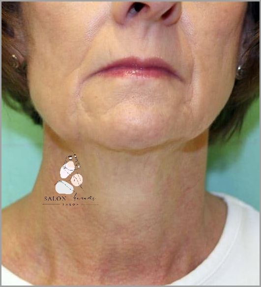 Zaskakujące Efekty Używania Preparatu Do Laminowania Włosów!