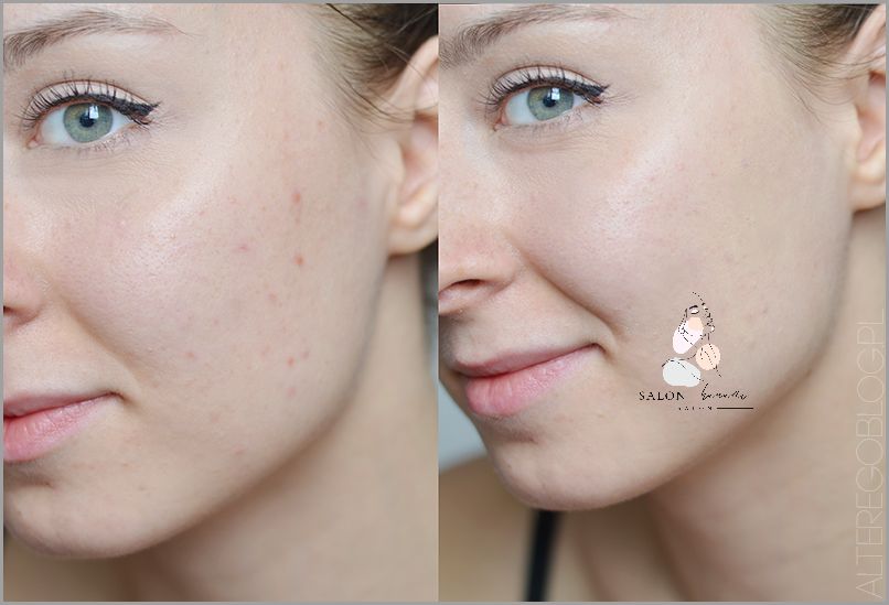 Zaskoczą Cię efekty Annabelle Minerals Korektor! Zaskoczą Cię efekty Annabelle Minerals Korektor!