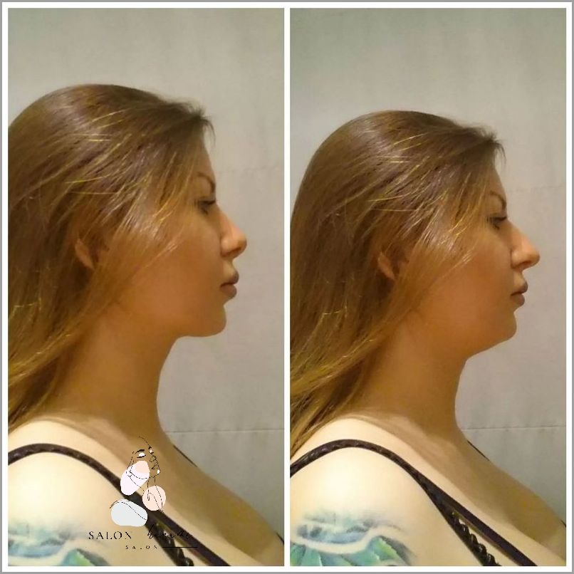 Efekt Mokrych Ust: Jak Go Osiągnąć?